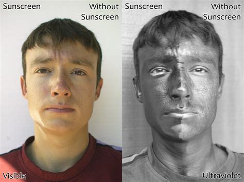can you get a sunburn after 5pm|sunscreen after 5pm.